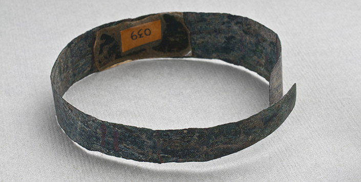 Brazalete (vista posterior)