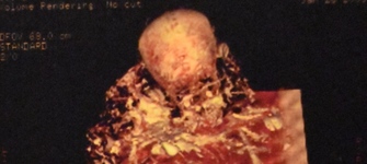 imagen imagen_portada.jpg