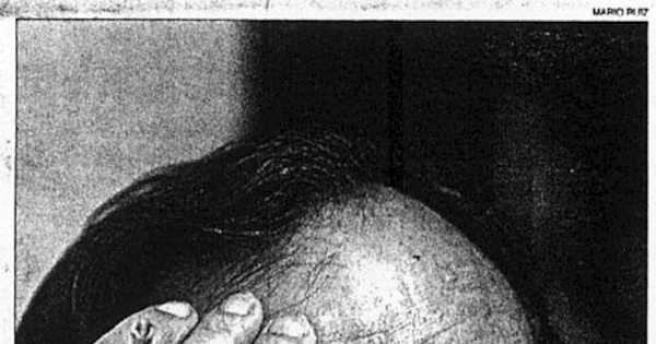 MC0045579