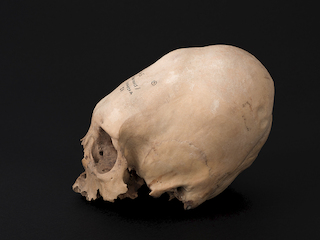 Cráneo con deformación anular oblicua, sitio Cxa E-6 (Conanoxa)