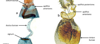 Figura 2. Preparaciones microscópicas de las estructuras genitales de dos polillas hembras. a) Oecophoridae, b) Tortricidae.