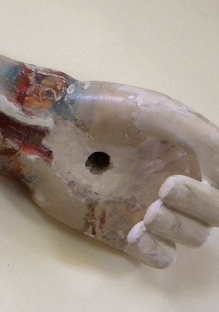 Resane en el antebrazo y manos