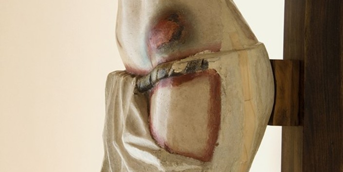 Cadera y reparación de la grieta