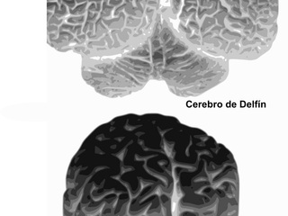 Comparación entre un cerebro de delfín y uno humano.