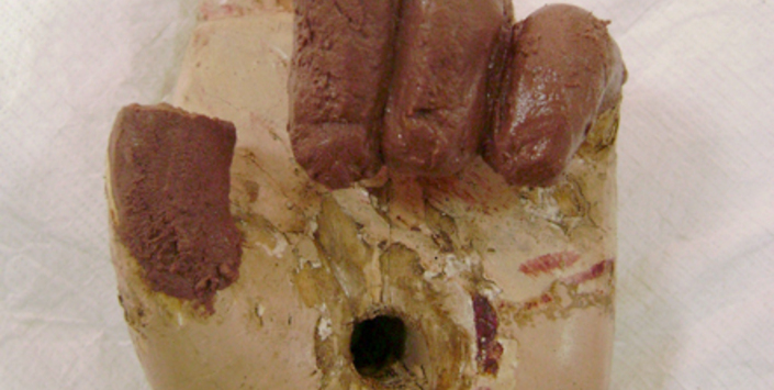 Modelado de dedos faltantes