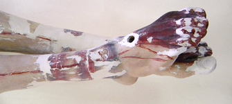 Resane en los pies y tobillos